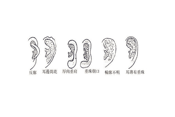 什么样的耳朵代表富贵