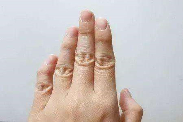 无名指看婚姻状态