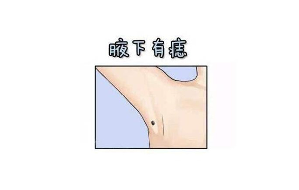 身体腋下有痣好吗