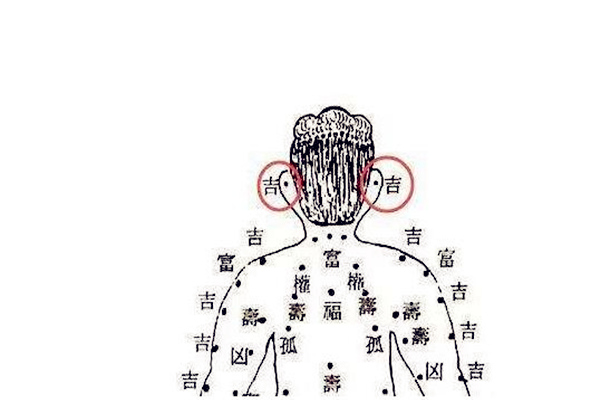 男孩头顶上长痣图解图片