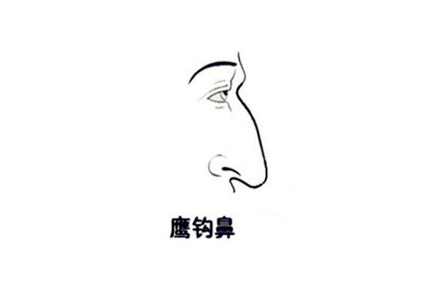 面相中鹰钩鼻的人好吗
